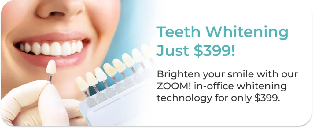 Teeth whitening special offer